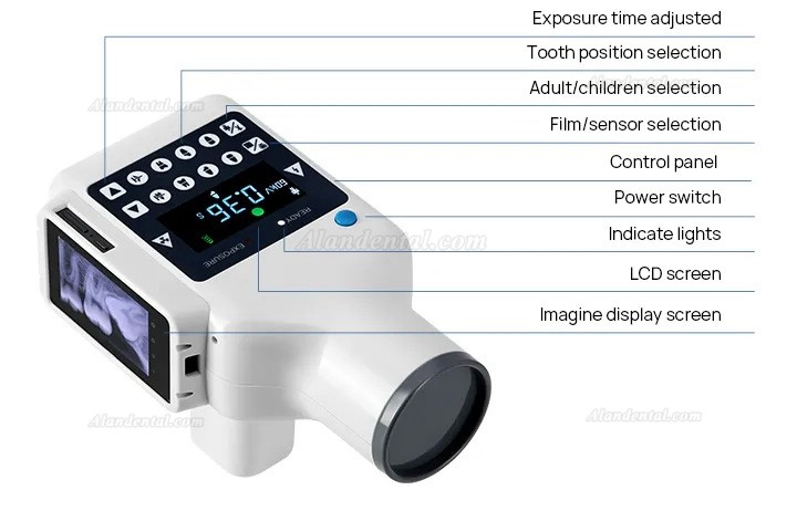 Dental Portable X-Ray Machine Built-in Screen X-Ray Unit with Dental Digital X-ray Sensor